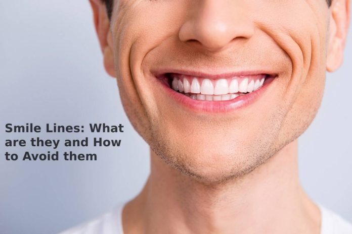 Smile Lines: What are they and How to Avoid them