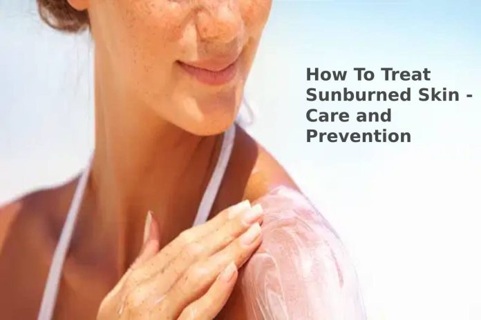 How To Treat Sunburned Skin - Care and Prevention