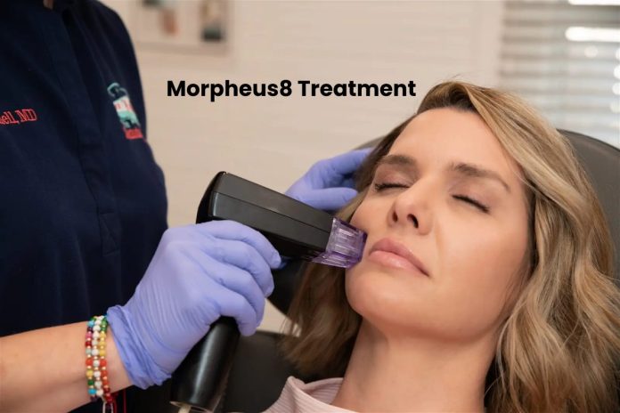 Morpheus8 Treatment