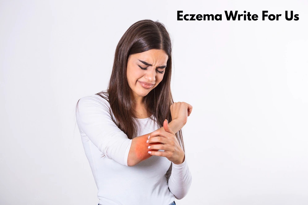 Eczema write for us